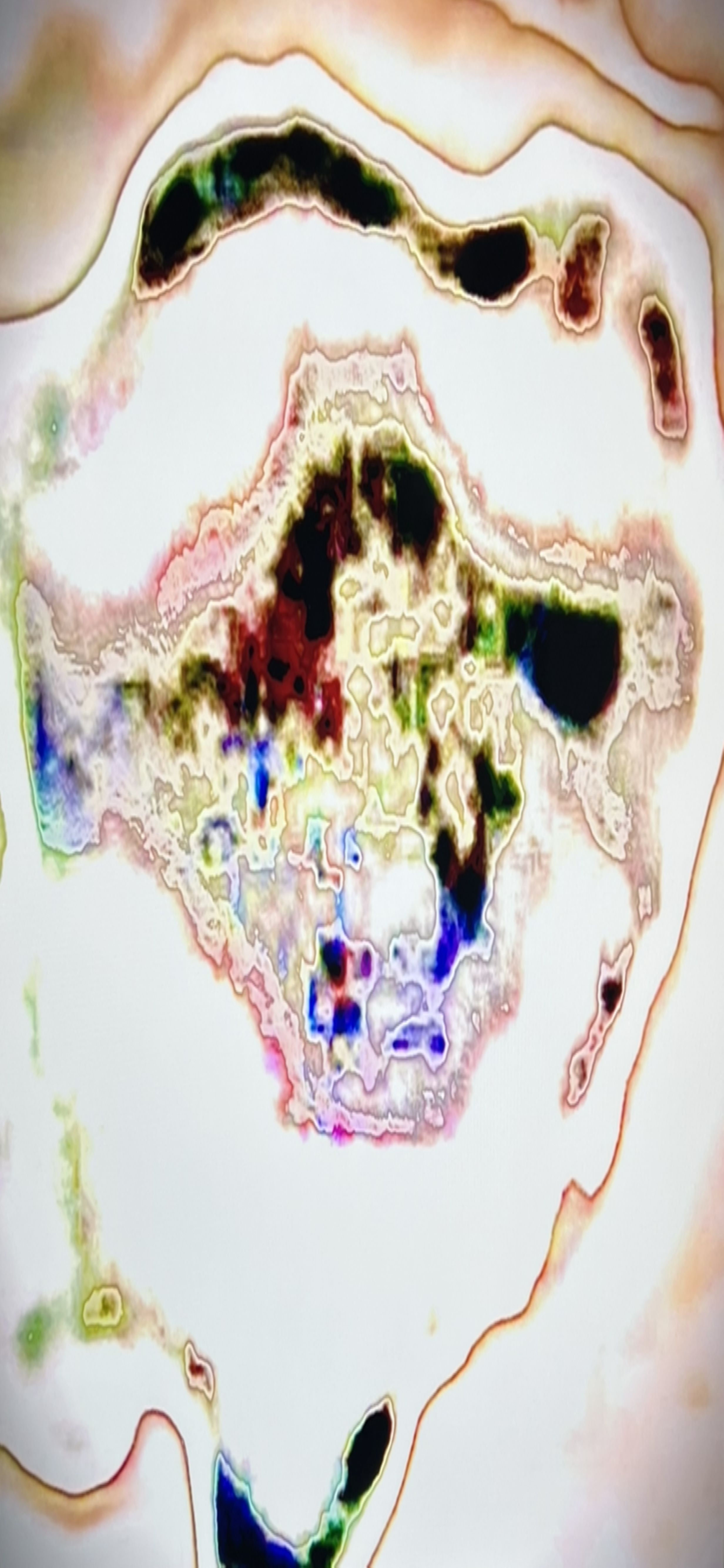 Abstract thermal imaging pattern showing dark clustered shapes within a pale cream and rose colored field